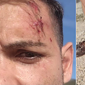 Dos periodistas de la televisión valenciana sufren una paliza a manos de varios ganaderos