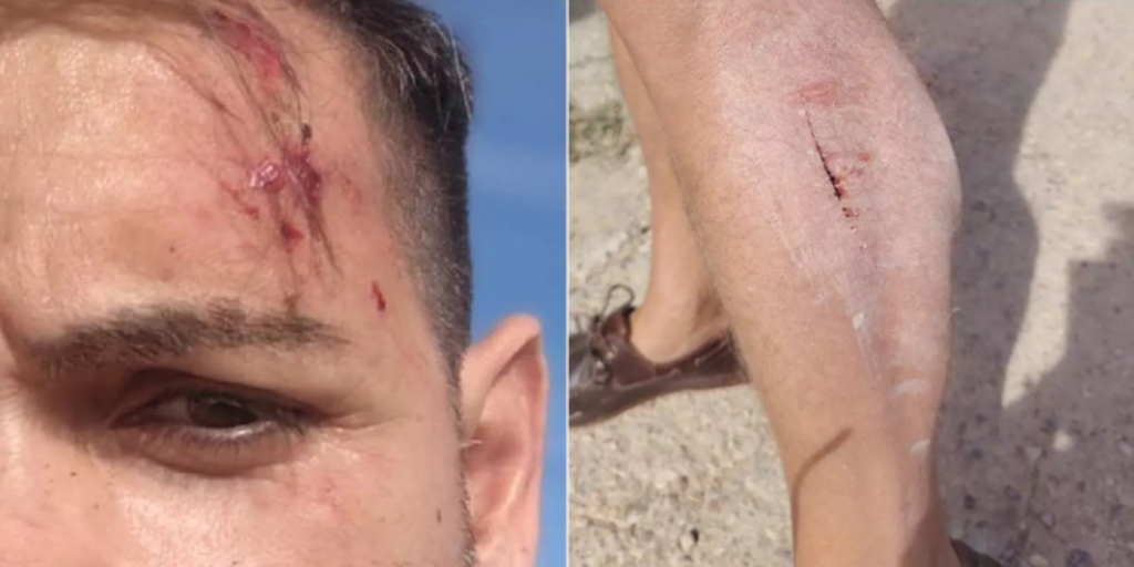 Dos periodistas de la televisión valenciana sufren una paliza a manos de varios ganaderos