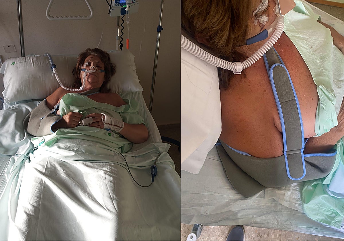 Imagen la mujer ingresada tras sufrir una paliza y el robo de su patinete en Valencia