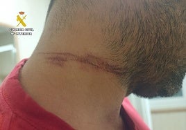 Investigan a un hombre que atravesó un cable en un camino de Salamanca por provocar un accidente de moto