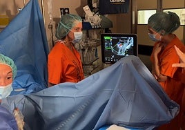 Madrid estrena una técnica pionera para eliminar miomas en mujeres jóvenes
