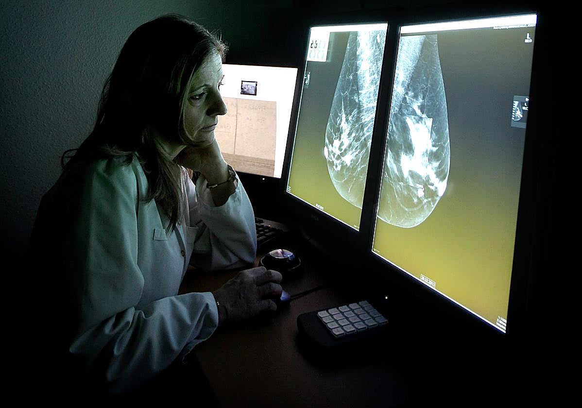 La jefa de Radiodiagnóstico del Reina Sofía observa una mamografía