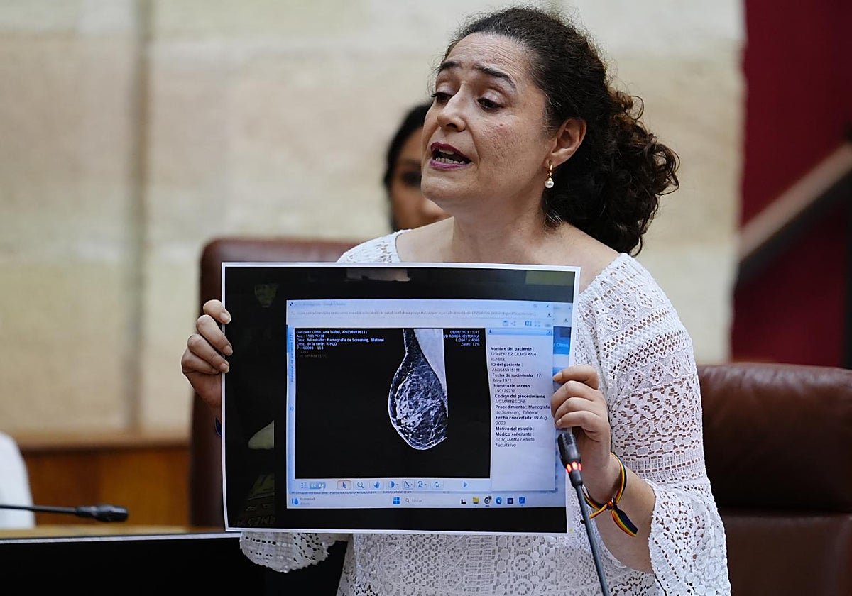 Inmaculada Nieto muestra una mamografía en el Pleno del Parlamento