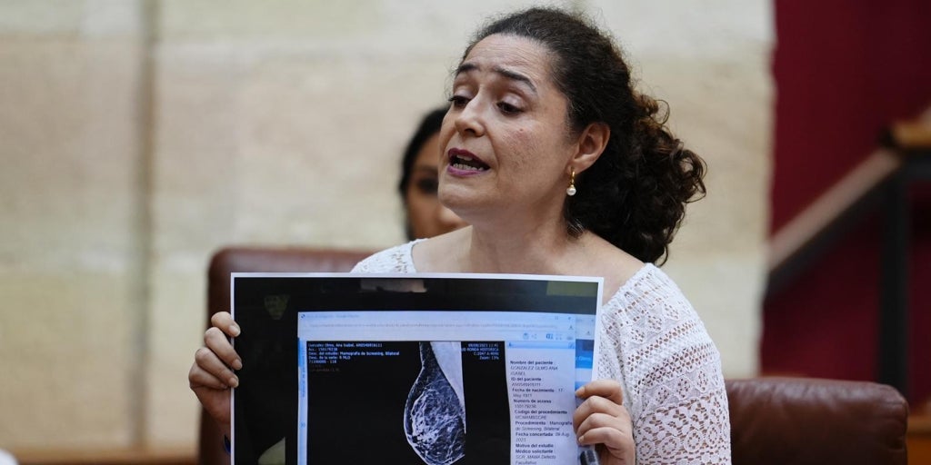 El SAS aclara que cada mamografía es analizada por dos radiólogos y que no puede borrarse