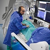 La Fe de Valencia, primer hospital en alcanzar las mil ablaciones de fibrilación auricular con electroporación