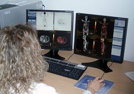 Castilla-La Mancha pondrá en marcha en 2026 el cribado de cáncer de pulmón