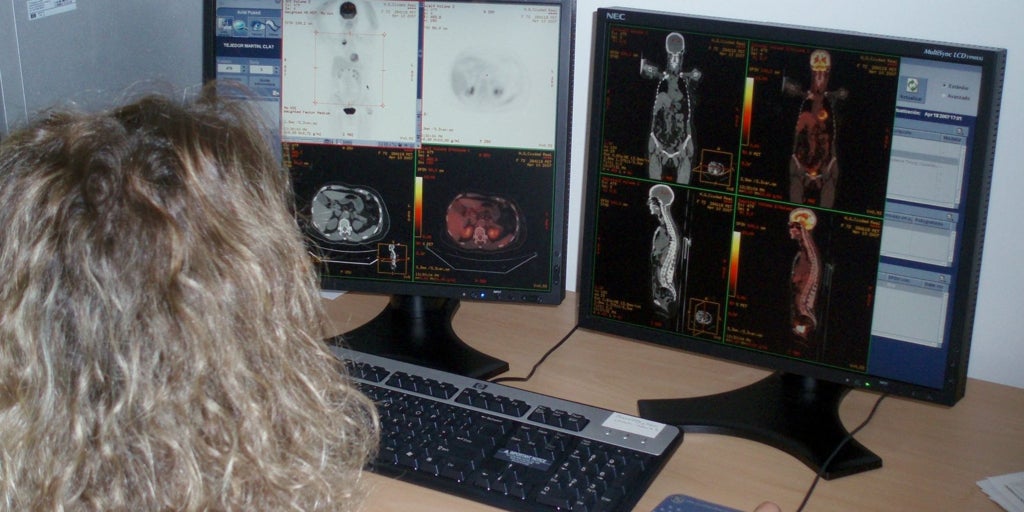 Castilla-La Mancha pondrá en marcha en 2026 el cribado de cáncer de pulmón