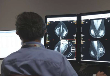 La IA para los nuevos cribados en Andalucía detecta un 54% más de cánceres de mama