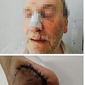 Las lesiones que han sufrido funcionarios de prisiones en actos de servicio