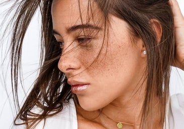 Qué es el melasma y cómo se puede eliminar esta mancha de la piel habitual en las mujeres