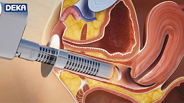 Ilustración de Monalisa Touch de Deka.