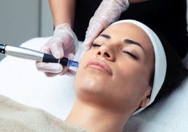 Dermapen: qué es y qué beneficios tiene para la piel