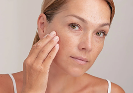 Las mejores cremas antimanchas para recuperar la piel después del verano