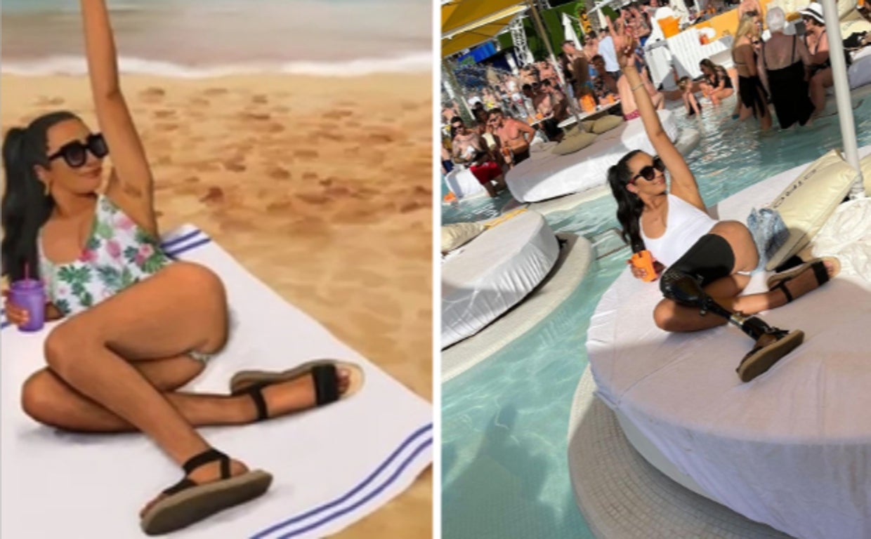 Otra modelo denuncia el polémico cartel de Igualdad por eliminar la prótesis de su pierna