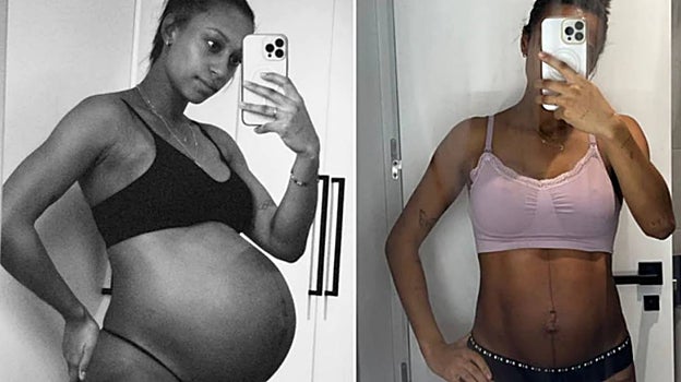 Ana Peleteiro durante y después del embarazo