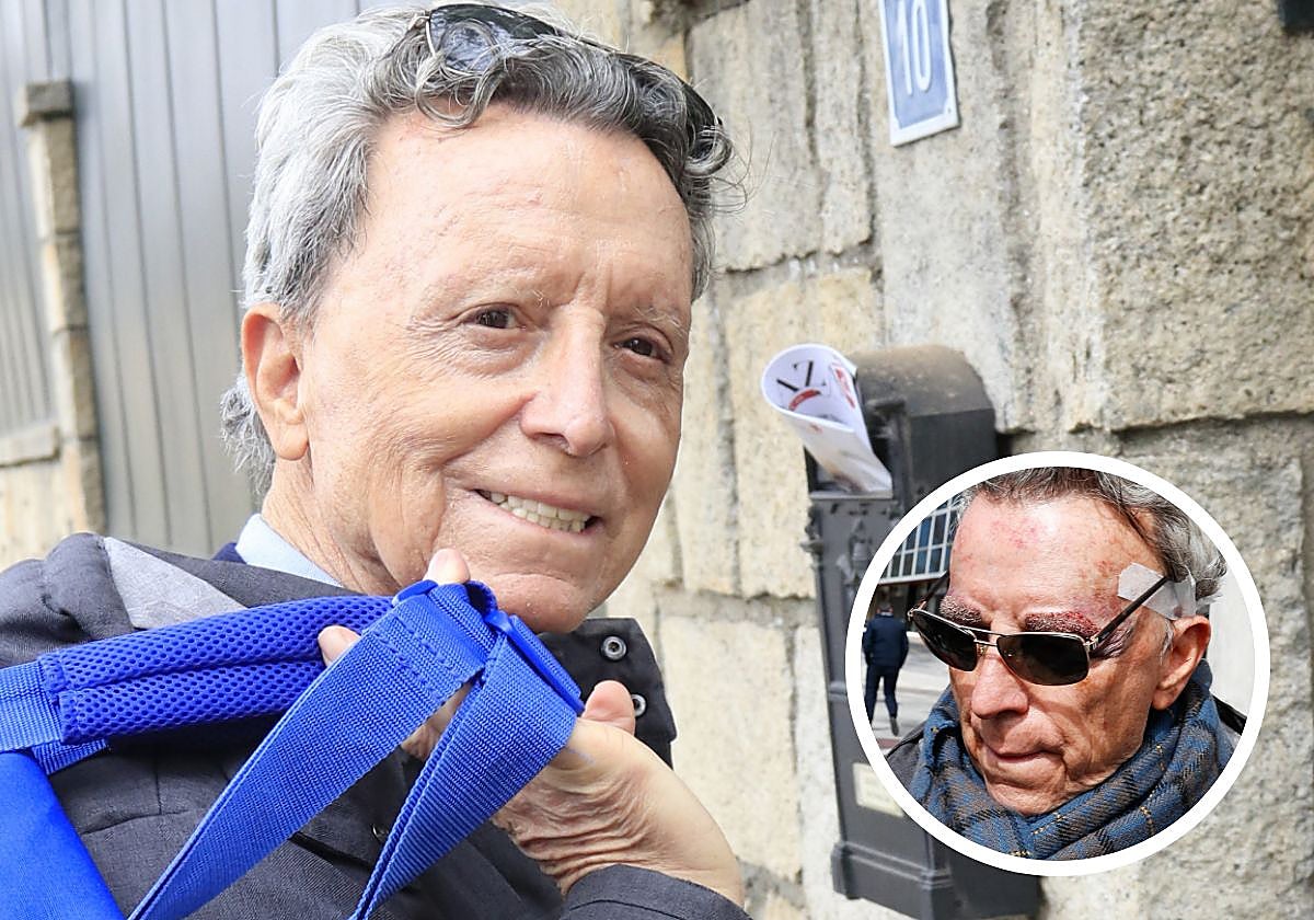 José Ortega Cano antes y después de hacerse el injerto de cejas