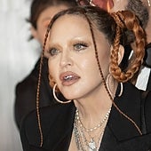 Madonna muestra los resultados de su lenta recuperación: «Poder mover mi cuerpo me hace sentir afortunada»