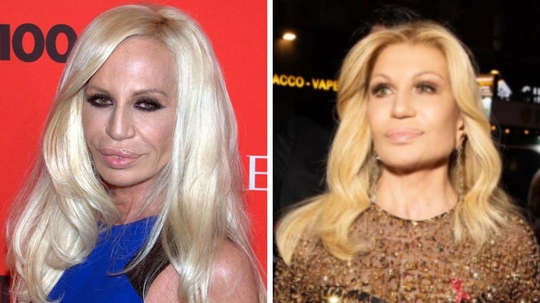 Donatella Versace antes y después