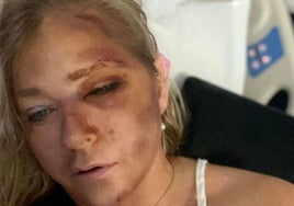 Virginia Giuffre abandona el hospital una semana después de estar «cerca de morir»