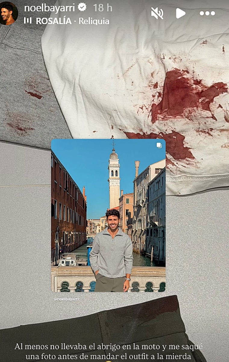 El 'Superviviente' Noel Bayarri sufre un accidente de moto: «Han tenido que coserme la cadera»