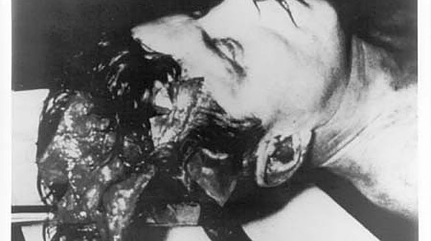 Kennedy, durante la autopsia