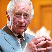 De los 'dedos de salchicha' de Carlos III a la diarrea de Jefferson: raras enfermedades que avergonzaron a líderes mundiales