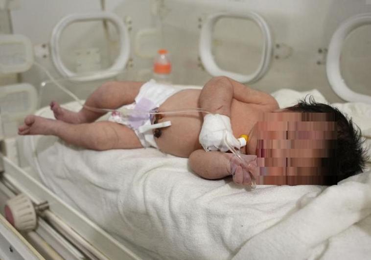 La recién nacida rescatada de los escombros del terremoto sobrevivió porque estaba conectada al cordón umbilical de su madre muerta