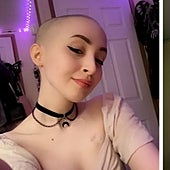 Una joven vende sus desnudos en OnlyFans para pagar el tratamiento contra un raro cáncer