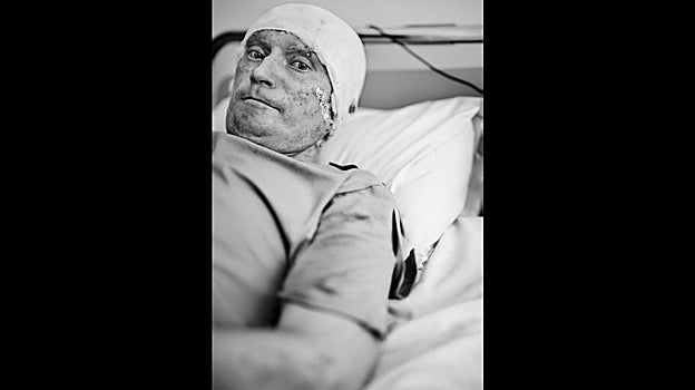 Durante en una operación en uno de los flancos del frente de Bajmut, el tanque de Andriy sufrió una emboscada de las tropas rusas. Él y su subordinado pudieron salir a duras penas de los restos del tanque en llamas. Ahora se recupera de sus quemaduras en la unidad de quemados del hospital de San Lucas en Leópolis