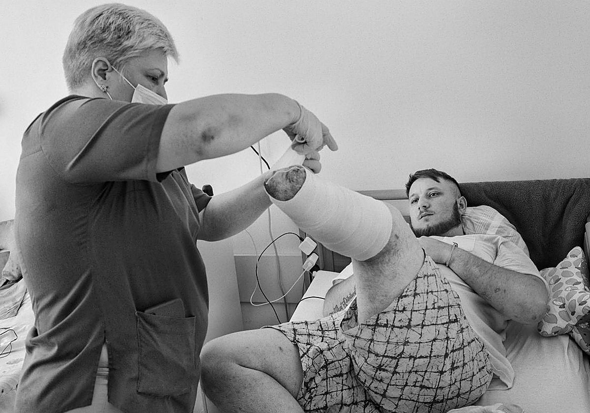 Andriy (apodo de guerra 'Sailor') era ingeniero de desminado en la brigada 150 de las defensas territoriales. Estaban limpiando una zona de bosque en la línea de Bajmut y calló en un trampa explosiva rusa que le hizo perder la pierna