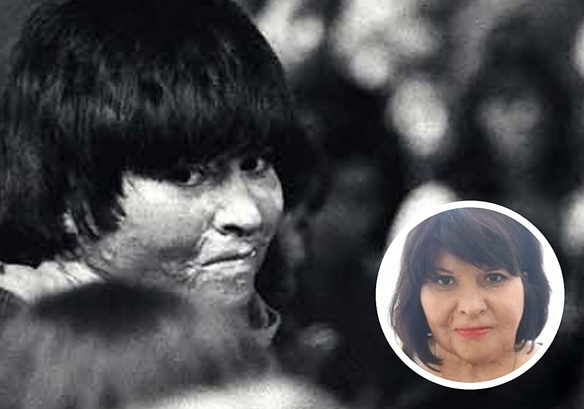 Carmen Gloria Quintana, antes y después de someterse a 40 intervenciones por las graves quemaduras que sufrió