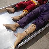 'DNIs de tinta' para los niños en Gaza: la desesperación lleva a los padres a escribir los datos de sus hijos en sus cuerpos