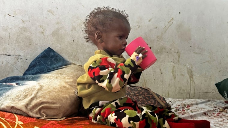 Un niño de tres años bebe leche tearapçeutica en el hsopital pediátrico de Sudán