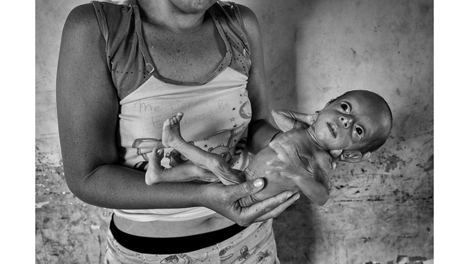 Maracaibo (Venezuela), abril de 2019. Katherine Castilla, de 19 años, muestra a su bebé que sufre de desnutrición extrema. Katherine vive en el Barrio Alto de Milagros Norte en Maracaibo. La población más vulnerable de Venezuela se está muriendo. El colapso total del sistema de salud del país, junto con el aumento exponencial de los precios de los alimentos, ha llevado a Venezuela a una emergencia humanitaria total.