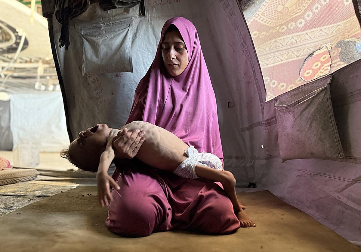 El pequeño gazatí Mohamed Motawaq, de tan solo 18 meses, de cuerpo esquelético pasa los días en Gaza en brazos de su madre, Hidaya al Mutauaq, un mujer viuda, de 30 años, sin apenas leche y otros productos básicos por las restricciones de Israel