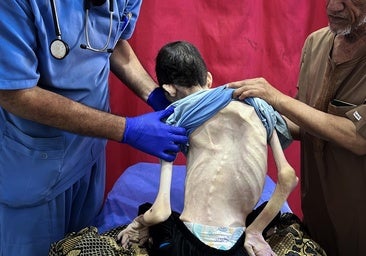 Israel, cada vez más enemistado con Occidente por la hambruna en Gaza