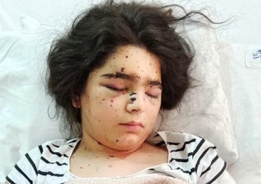 «¡Para nosotros, Siria se acabó!»