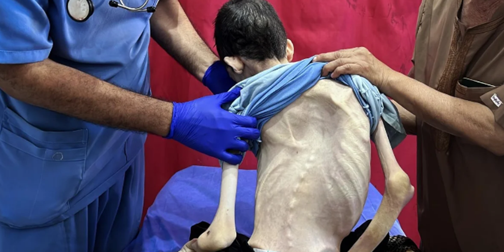 Contando calorías en el infierno: lo que contienen las polémicas cajas de ayuda en Gaza y por qué no resuelven la crisis