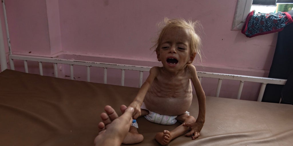 Aumentan a más de 315 los muertos por hambre en Gaza por la ofensiva de Israel, incluidos más de 120 niños