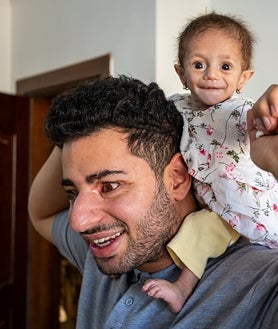 Imagen secundaria 2 - Zerat solo pesa cuatro kilos. Su padre Saleh, a pesar de su ceguera, juega con su hija bajo la atenta mirada de su madre, Ziuar