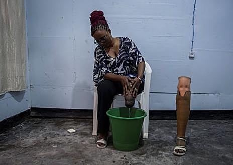 Imagen secundaria 1 - Wivine Kavira Mukata trabaja sus prótesis en su taller en Goma (RDC)