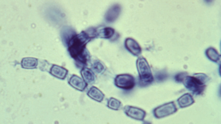 Los supermicrobios en forma de esporas microscópicas de hongos son una amenaza creciente: «Algo está pasando que se están adaptando y son capaces de provocar lesiones graves»