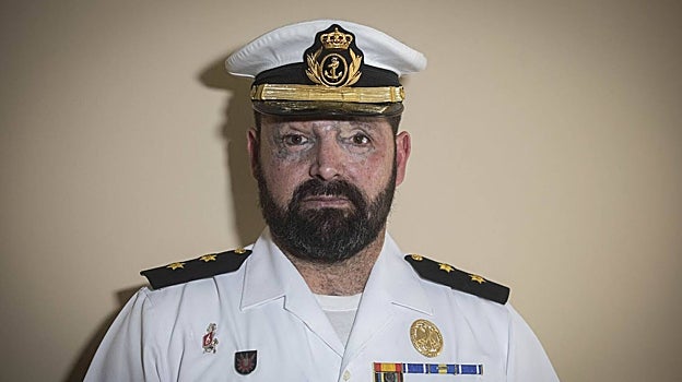 El teniente José Manuel Candón, sin gafas, muestra el estado de sus lesiones oculares tras años de recuperación de la explosión de Hoyo de Manzanares