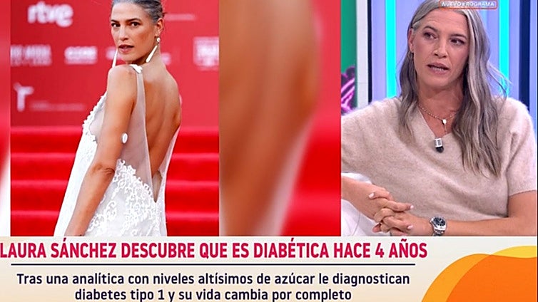 La modelo Laura Sánchez y su reivindicación del envejecimiento natural: «Las arrugas me importan muy poco y lo del pelo es…»