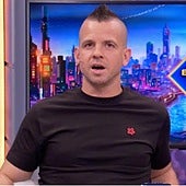 Dabiz Muñoz revela el raro trastorno que padece: «En algún momento de mi vida me he rayado con esto»