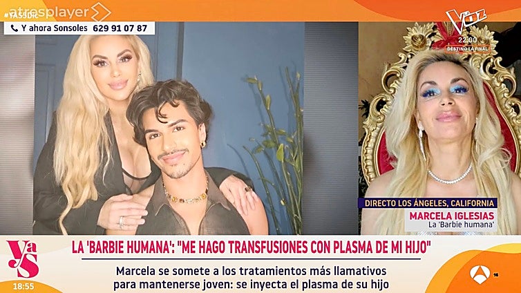 Marcela Iglesias, la 'Barbie humana': «Me transfieren plasma de mi hijo para regenerar mis células más rápido»