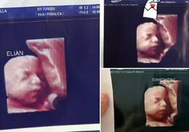 «¡Tengo la misma foto!»: embarazadas denuncian en redes sociales que las estafaron con la ecografía 5D