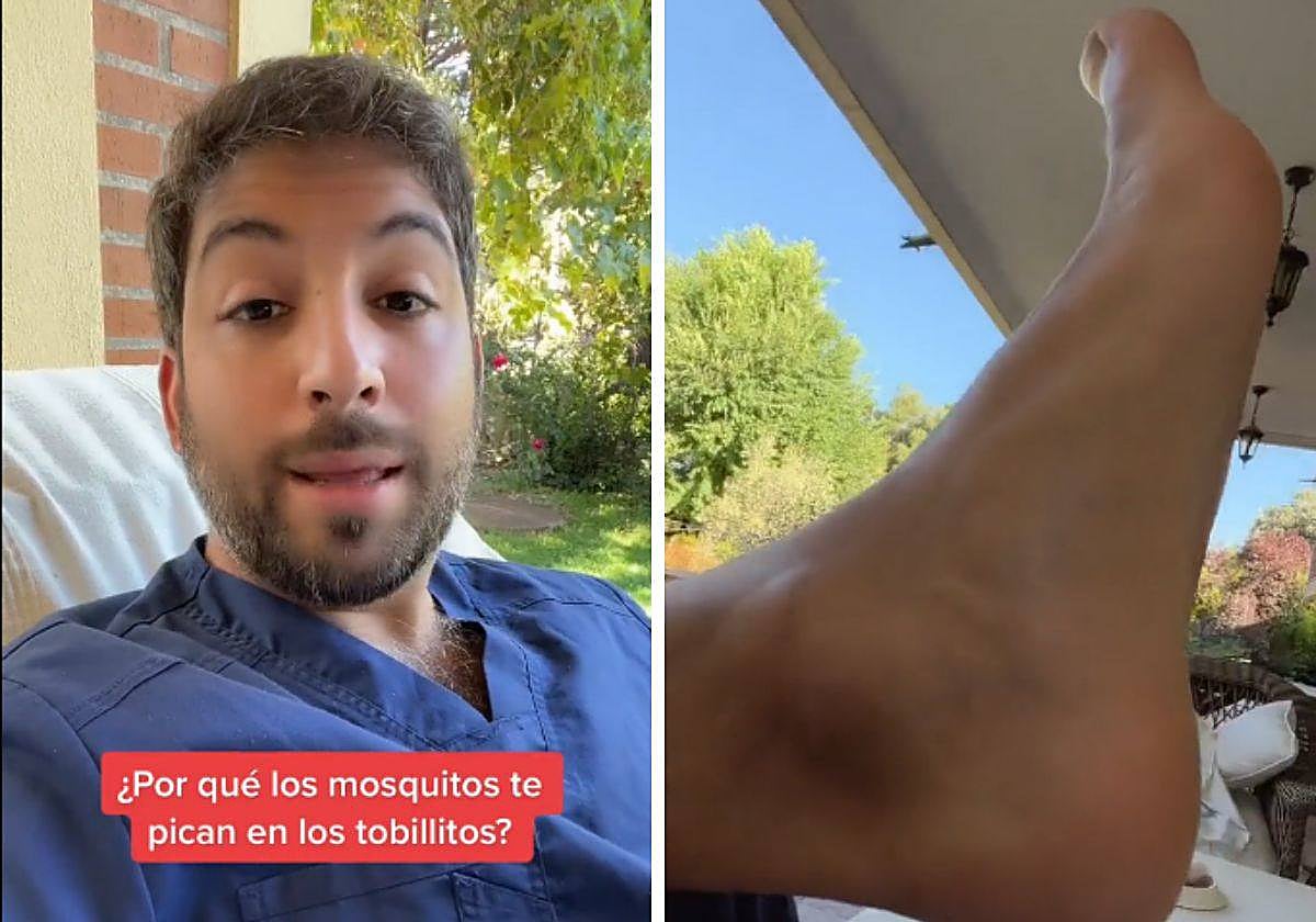 Un farmacéutico explica por qué los mosquito pican en los tobillos