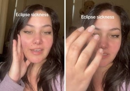 Una mujer denuncia que ha enfermado tras contemplar el eclipse de Sol: «Me tiemblan las manos»