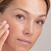 Una dermatóloga aclara si hay que utilizar protector solar en invierno